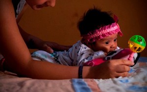 Cuba xác nhận trường hợp nhiễm virus Zika thứ 3