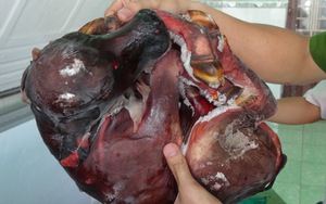 Cả xã hội sôi sục vì bữa cơm lành