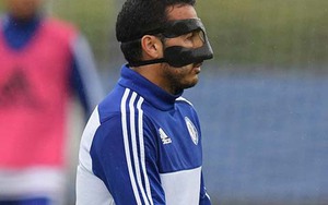 Pedro phải đeo mặt nạ vì tai nạn hy hữu