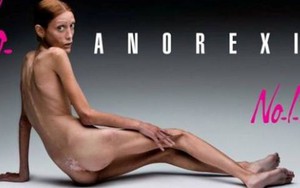 Bức ảnh quảng cáo 'chống biếng ăn' gây choáng váng