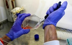 Mỹ ra mắt hệ thống dữ liệu tiêu chuẩn điều trị ung thư