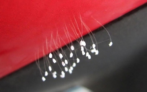 Hoa ưu đàm nở đầy trên thế giới?