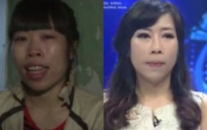 Chương trình 'Thay đổi cuộc sống': Mẹ không nhận ra con gái sau phẫu thuật