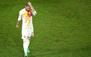 Kẻ chiến bại Tây Ban Nha: Màu đỏ và sự yếu đuối