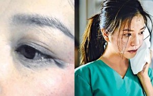 Triệu Vy kể chuyện bị Cổ Thiên Lạc tát tím mặt trên phim trường