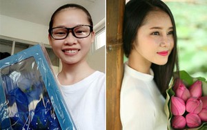 Nguyễn Hà My: Thay đổi diện mạo vì một vết chàm