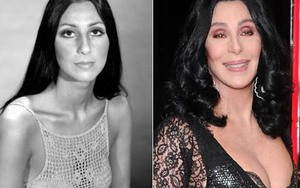 Bài 4: Phẫu thuật thẩm mỹ & Trở lại với gương mặt mình