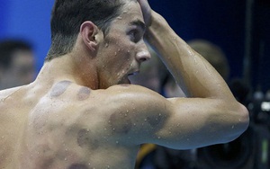 Vì sao Michael Phelps và VĐV Mỹ mê... giác hơi?