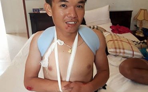 Con trai HLV Trần Văn Quýt té gãy xương vai trên đường tập