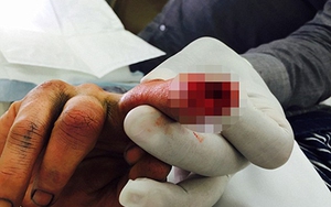 Sốc: 'Cướp biển' Johnny Depp viết lời cáo buộc vợ bằng máu