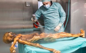 'Sự tàn bạo' của xác ướp Oetzi