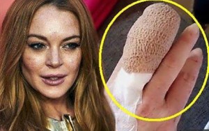 SỐC: Lindsay Lohan mất nửa ngón tay vì tai nạn