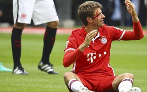 Mueller đổ cả máu, Bayern Munich vẫn chia điểm thất vọng