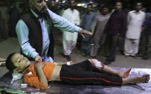 Hình ảnh rơi lệ về vụ đánh bom khủng khiếp ở Pakistan