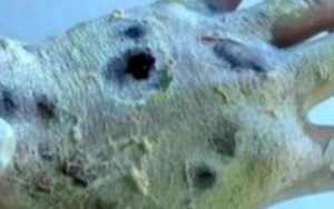 Cảnh báo về tác hại loại 'ma túy cá sấu' nguy hiểm nhất thế giới