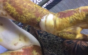 Vụ nữ sinh bị bỏng tại phòng thực hành: Khiển trách Hiệu trưởng