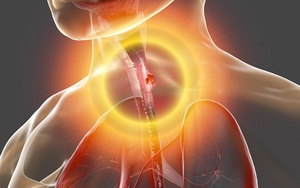 Người đàn ông bị ho uống thuốc mãi không khỏi, đi khám bàng hoàng phát hiện mắc căn bệnh khiến 3.000 người tử vong mỗi năm