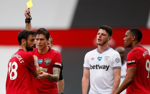 MU: Vắng Bruno Fernandes, Ten Hag xoay sở ra sao?