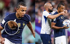 Sao tuyển Pháp đối mặt án phạt vì đeo dây chuyền đá bóng