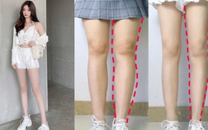 Chân "to như cột đình" triển ngay 4 động tác đơn giản này sẽ thấy chân thon gọn, tự tin diện váy vóc hơn