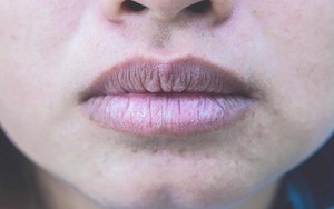 3 vùng trên cơ thể nữ giới chuyển sang màu đen có thể là dấu hiệu tử cung đang chất chứa nhiều độc tố