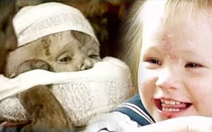 Cuộc giải cứu bé gái 18 tháng ngã xuống giếng từng khiến thế giới nghẹt thở, kết cục sau cùng nằm ngoài sức tưởng tượng của tất cả