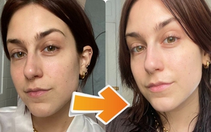 Thử dùng thành phần "sinh đôi" với retinol: Kết quả làn da tuổi 31 láng mịn chỉ sau 3 tuần