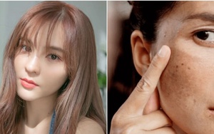 4 loại bột collagen làm nên "điều kỳ diệu" cho làn da lão hóa