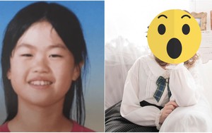 Chi tiền tỷ làm phẫu thuật từ năm 18 tuổi để được “giống người thường”, diện mạo của idol người Nhật bây giờ ra sao?