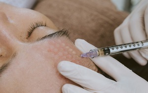 Cuối năm có 1 hình thức làm đẹp siêu hot vì hiệu quả nhanh, ít xâm lấn, chị em quan tâm nhất định phải nắm rõ những điều này