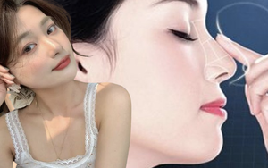 Phương pháp thẩm mỹ này được nhiều người tranh thủ làm trước Tết, bác sĩ khuyên cần "đầu tư" 1 thứ để đẹp hơn