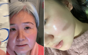 Dùng thử tuýp kem dưỡng ẩm của cụ bà U70 sở hữu làn da em bé, cô bạn nhận cái kết... 'sướng rơn'