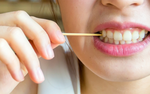 Chuyên gia cảnh báo những tác hại khôn lường khi dùng tăm xỉa răng: Nhẹ thì rách mô nướu, nặng thì gây nhiễm trùng, phá vỡ thủ thuật nha khoa