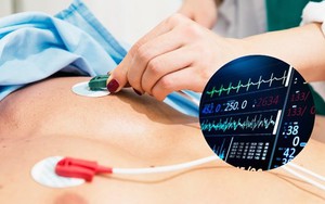 Phương pháp mới giúp chẩn đoán nhanh chứng nhồi máu cơ tim