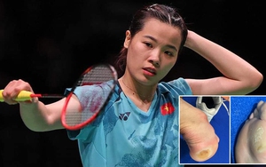 Cận cảnh gót chân Thùy Linh bị trầy xước sau trận thua ở giải Đan Mạch mở rộng