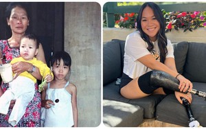 Cuộc sống hiện tại của bé gái gốc Việt bị bố mẹ nổ bom mất 2 chân: Được báo chí thế giới gọi là 'nữ kình ngư thần kỳ', trở thành đại sứ truyền cảm hứng cho những người khuyết tật