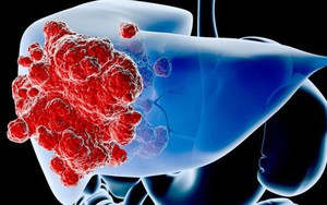 ‘Gan là 1 vị tướng’, gan tắc nghẽn, trăm bệnh cùng tìm đến: Thực hiện động tác kéo dài 10 giây này, không lo bệnh tật  