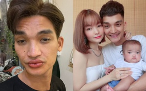 Mạc Văn Khoa bị sưng tấy môi vì làm đẹp để đóng phim, về nhà con gái không nhận ra
