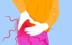 Khớp và xoang của mẹ tôi là nhà dự báo thời tiết: Chúng biết trời sắp nồm ẩm trước cả nhà đài