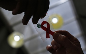 Kì diệu: Thế giới lại vừa có thêm 1 người chữa khỏi HIV, ông ấy là bệnh nhân thứ 5 làm được điều đó