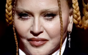 Madonna cuối cùng thừa nhận phẫu thuật thẩm mỹ sau lần xuất hiện không thể nhận ra tại lễ trao giải Grammy