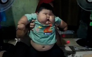 Cuộc sống của cậu bé 'khổng lồ' 16 tháng tuổi đã nặng 27kg, không thể tự đứng thẳng hay bước đi, mặc đồ của bố mới vừa