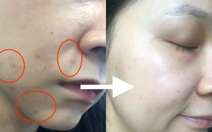 Dùng thử dầu dưỡng da giá 150k mà beauty blogger Trinh Phạm gợi ý: Lên da mịn mướt, vết thâm mờ hẳn sau vài ngày