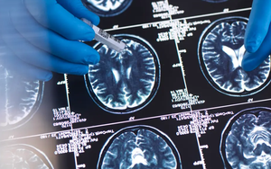 Thử tài "bắt mạch" của ChatGPT, bất ngờ khả năng chẩn đoán chính xác tới 80% căn bệnh đang dày vò hơn 50 triệu người trên toàn thế giới