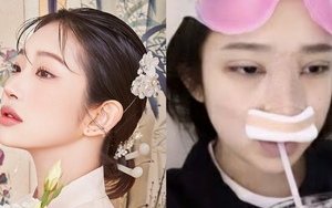 Con gái nữ minh tinh quá cố Choi Jin Sil công bố loạt ảnh ngay sau khi phẫu thuật thẩm mỹ: Bày tỏ sự hối hận?