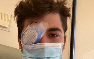 Chàng trai 21 tuổi đi ngủ quên tháo kính áp tròng, khi thức dậy thì giác mạc đã bị hỏng