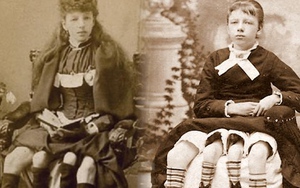 Cô gái 4 chân nổi tiếng như minh tinh, từng là niềm mơ ước của bao chàng trai