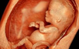 Kỳ lạ người phụ nữ mang thai suốt 9 năm: Thai nhi hoá đá, người mẹ sau cùng tử vong vì suy dinh dưỡng