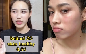 Dùng retinol bị kích ứng bong tróc, HH Đỗ Hà phải nhờ cậy cặp đôi serum + kem dưỡng để cứu vớt làn da