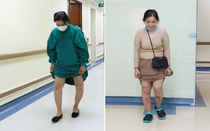 Mặc cảm vì chân vòng kiềng nặng, người phụ nữ hạnh phúc khi được đi thẳng như bao người